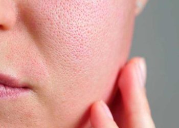 ¿Cómo eliminar los poros abiertos de la cara?