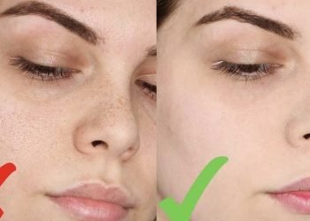 ¿Cómo tener una cara lisa sin poros abiertos?