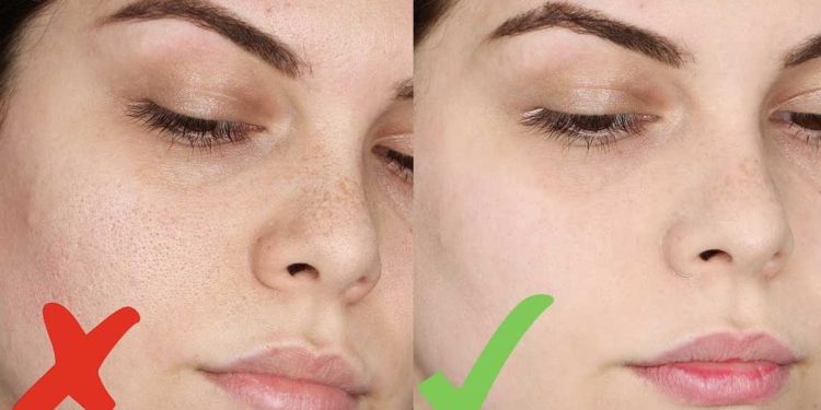 ¿Cómo tener una cara lisa sin poros abiertos?