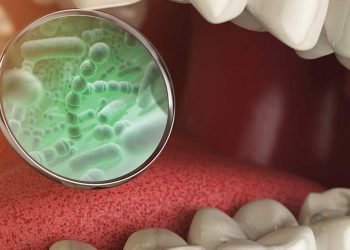 ¿Cuándo una infección dental es grave?