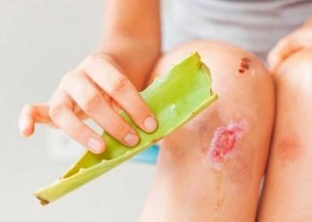 ¿Cuánto tiempo se debe dejar el aloe vera en una herida?