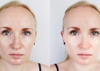 ¿Qué debo hacer para blanquear la cara?