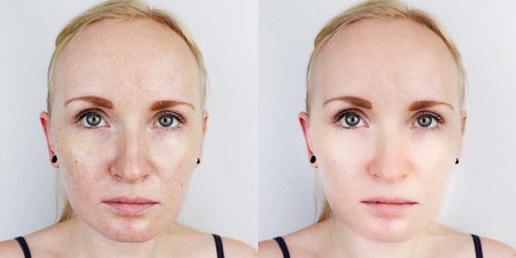 ¿Qué debo hacer para blanquear la cara?