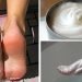 ¿Qué es bueno para hidratar los pies?