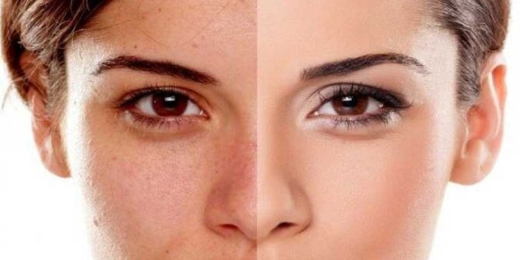 ¿Qué hacer para tener una piel de porcelana?