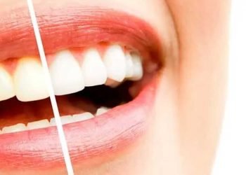 ¿Qué pasta de dientes es buena para blanquear los dientes?