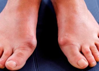 ¿Cómo empieza la diabetes en los pies?