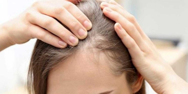 ¿Cuándo se cae el pelo por estrés vuelve a crecer?