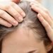 ¿Cuándo se cae el pelo por estrés vuelve a crecer?
