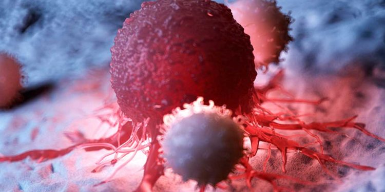 ¿Qué tipo de cáncer es el que mata más rápido?