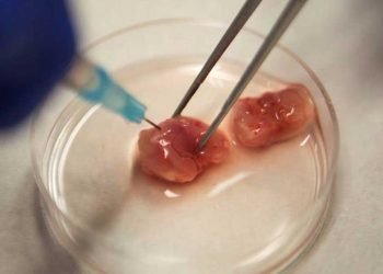 ¿Qué tipo de cáncer no tiene cura?