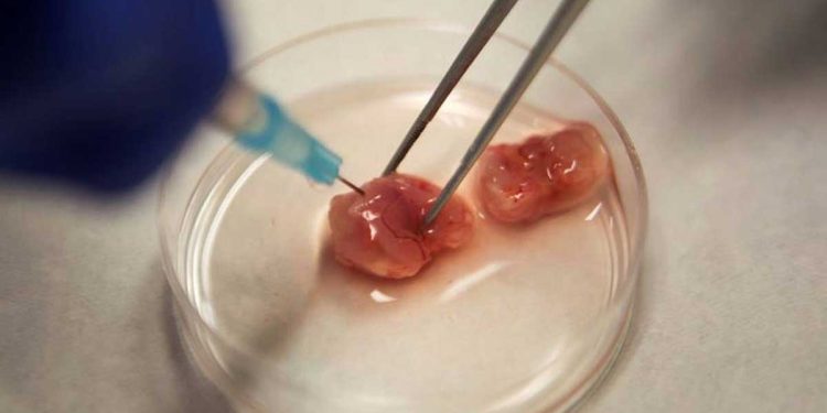 ¿Qué tipo de cáncer no tiene cura?