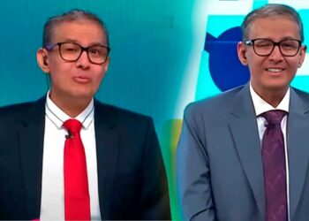 Erick Osores revela  con tristeza que no podrán operarlo: “Mi ojo ya no se volverá a abrir”